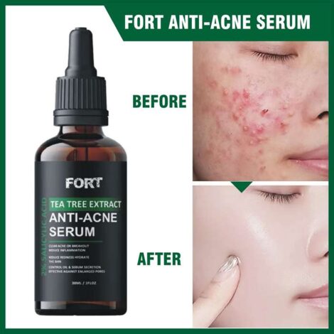 FORT Salicylic Acid Serum – Powerful Anti-Acne & Dark Spot Solution for Clear, Glowing Skin