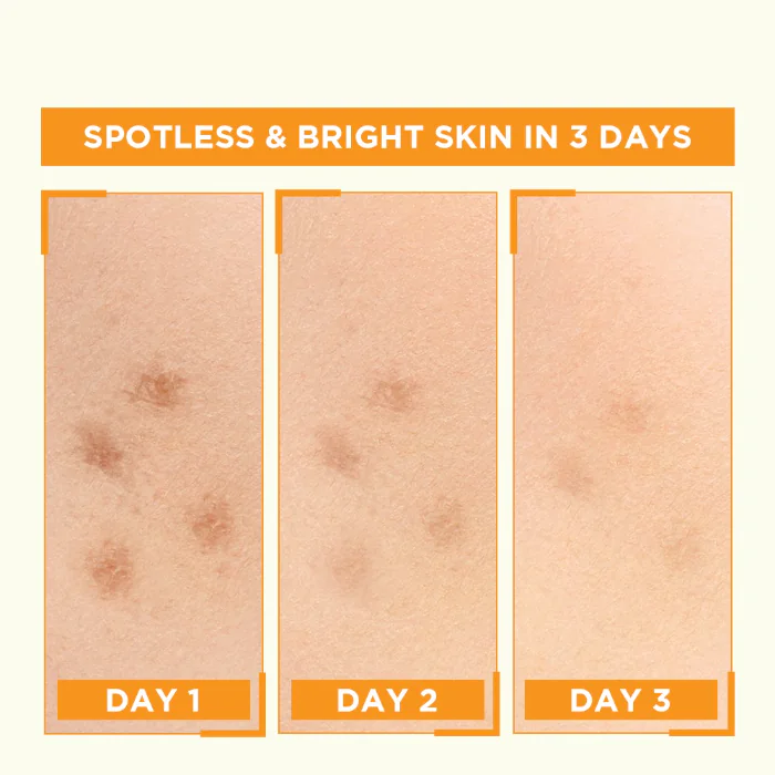 garnier vitamin c serum price in pakistan 6
